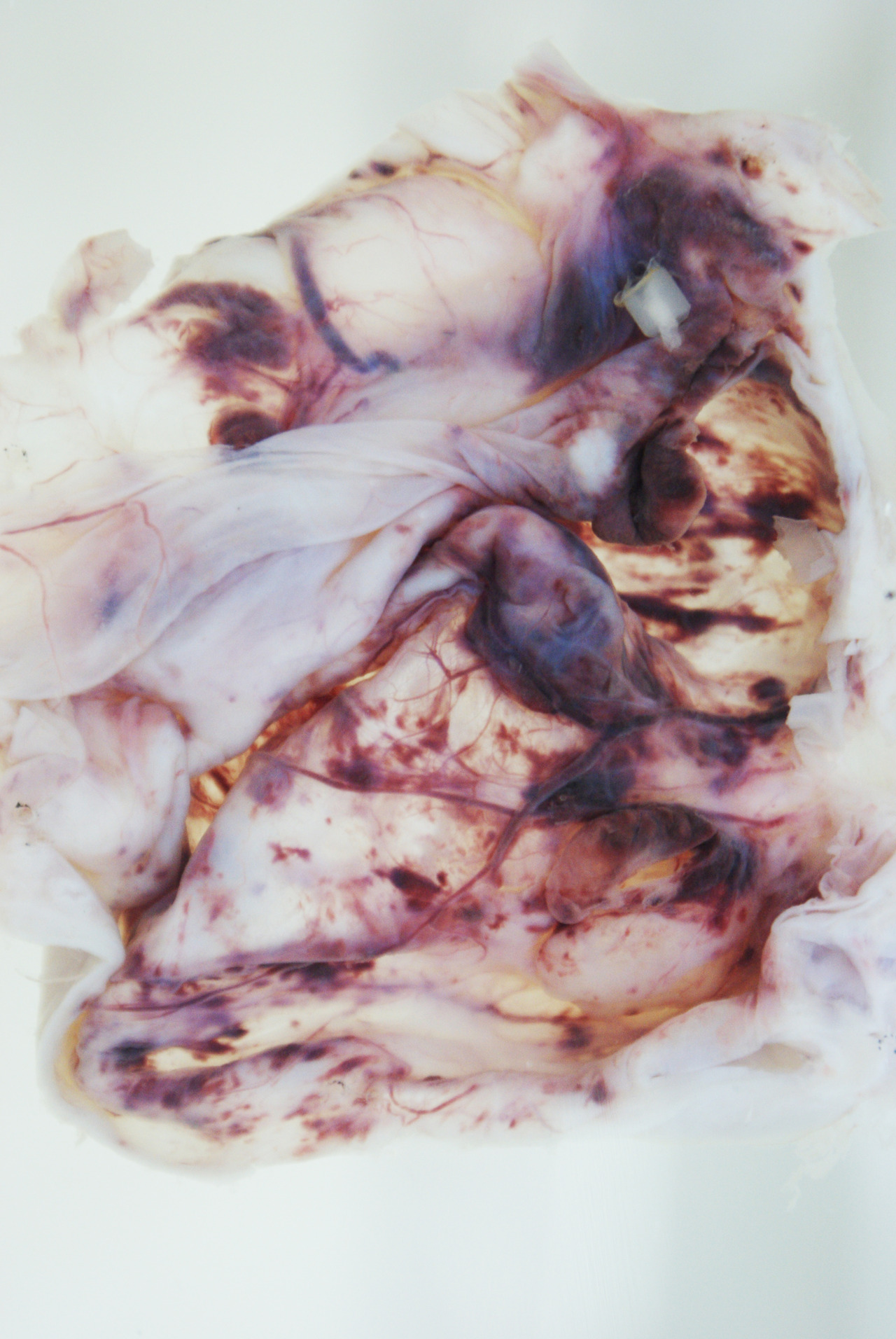 MIA-JANE HARRIS 'Beautiful Corpse' (2012-2013)